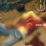 Hombre recibe varias puñaladas tras ser víctima de asalto nicaragua
