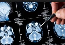 Un robot chino vence a 15 médicos en el diagnóstico de tumores cerebrales