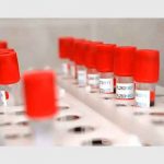 Rusia anuncia fecha de registro de la primera vacuna contra el coronavirus rusia