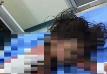 Niña se quema las pompis al caer en una olla con maíz hirviendo nina quemada