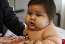 Costa Rica en alerta por sobrepeso y obesidad infantil nino obeso