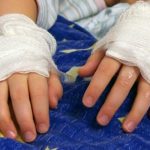 Capturan a mujer por quemar las manos a su hijo en Choluteca, Honduras honduras