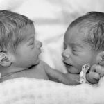 Colombia: Científicos identifican a dos mellizos de padres diferentes colombia