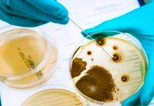 Confirman tercera muerte en España por brote de listeriosis espana