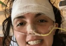 Canadá: Le explota el cerebro mientras miraba tele y sobrevive canada