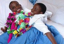 Las mellizas siamesas de Tanzania cuya muerte conmovió al país africa