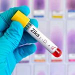 Identifican por el que el virus del Zika causa la microcefalia salud