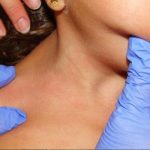 Niña es aislada por una rara enfermedad ninca