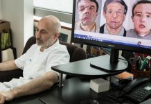 Jérôme Hamon, hombre de las 3 caras habla tras un nuevo trasplante