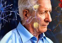 Ciencia: Revelan cómo se puede «transmitir» el Alzheimer cientificos