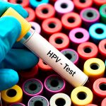 Pruebas genéticas de VPH son claves para detectar el cáncer cervicouterino salud
