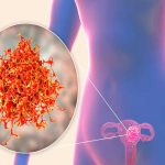 Sanofi anuncian «resultados positivos» en fármaco contra cáncer de útero mundo