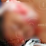 Mujer grave tras ser macheteada por su pareja en Juigalpa nicaragua