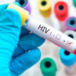 Conocimiento vital: La diferencia entre los términos VIH y SIDA salud