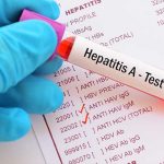 Ya son 690 los casos de hepatitis A en Florida estados unidos