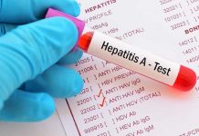Ya son 690 los casos de hepatitis A en Florida estados unidos