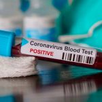 Casos confirmados de coronavirus en Costa Rica ascendió a 87 costa rica