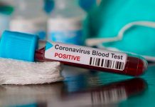 Casos confirmados de coronavirus en Costa Rica ascendió a 87 costa rica