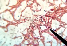 Bacterias mutan en el espacio y vuelven a la Tierra más agresivas Bacterias mutan en el espacio