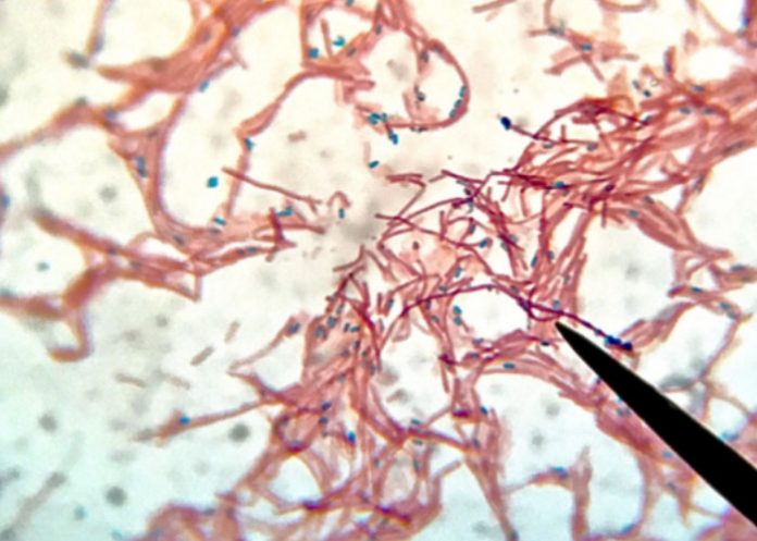 8_fSlpRfW Bacterias mutan en el espacio