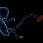 Bebé demonio sorprende durante un ultrasonido (Fotos) bebe demonio