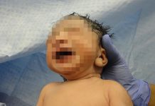 Mujer con coronavirus da a luz a un bebé sano en Honduras bebe sano