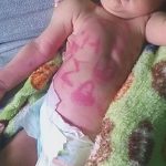 Bebecita aparece con terrible mensaje en el abdomen bebe