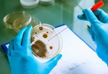 Brote de listeriosis comienza a remitir en España espana