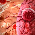 La clave para el diagnóstico del cáncer de pulmón está en la nariz descubren