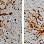 Descubren en el cerebro células que continúan creciendo después de la muerte ciencia