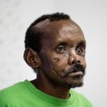 Visión ciega, el extraño fenómeno de la neurociencia cognitiva cirujano espanol