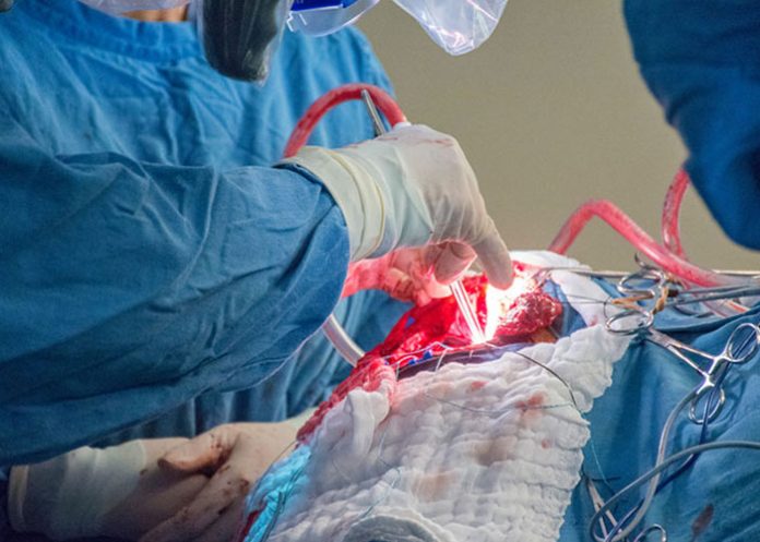 Cirugia hospital kenyatta national de nairobi