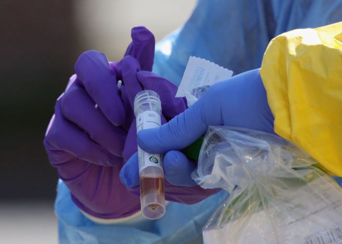 Coronavirus_Pandemia_MOCC9RC venezuela