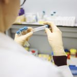 Cifra de infectados de coronavirus aumenta a 86 en Perú pandemia