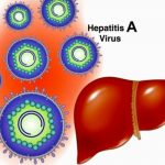 Confirman 140 casos de hepatitis A en Alajuela, Costa Rica costa rica