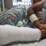 Honduras reporta tres personas quemadas por pólvora previo a la Navidad navidad