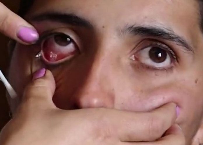 sindrome de munchhausen