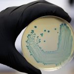 brote de listeriosis