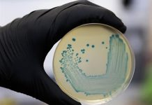 Declaran nueva alerta sanitaria por listeriosis en el sur de España brote de listeriosis