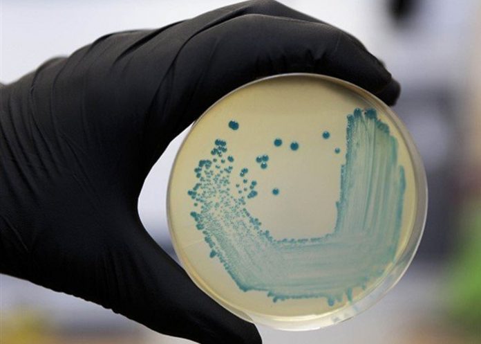 brote de listeriosis