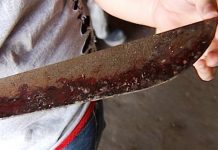 De varios machetazos y casi decapitado murió un hombre en El Tortuguero hombres agresores