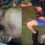 Motociclista arrolla a ciudadano acostado sobre la vía en Carazo san marcos