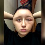 Se tinturó el cabello y su cara sufrió inesperada deformación (Fotos-Video) francia