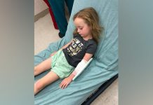 Niña sufre parálisis repentina: Tenía un animal en su cabello paralisis