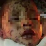 Niño muere tras ser picado por abejas africanizadas en Honduras honduras