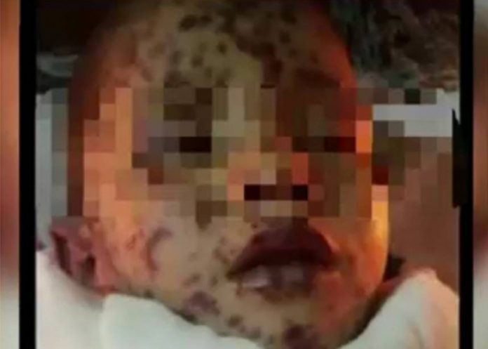 Nino-picaduras-de-abejas-Honduras honduras