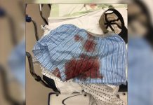 Luchador de UFC se lesionó el escroto con un taladro eléctrico nicaragua