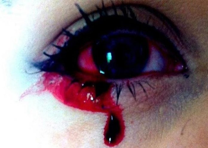 llorar sangre