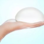 Implantes mamarios, estos son 6 datos que no sabías de ellos protesis