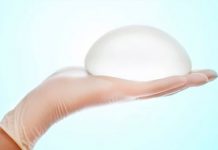 Implantes mamarios, estos son 6 datos que no sabías de ellos protesis